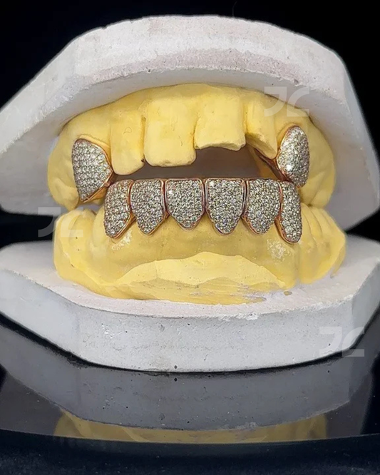 Iced Out Custom VVS Moissanite Diamond 925 Silver Grillz