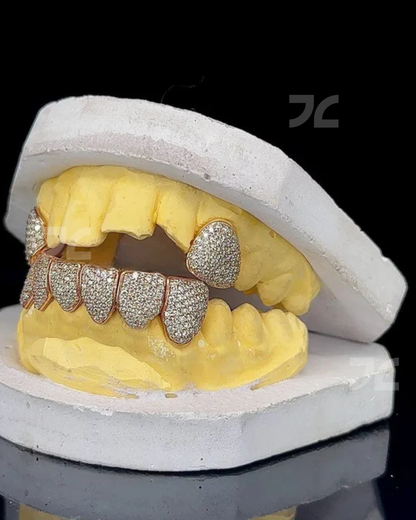 Iced Out Custom VVS Moissanite Diamond 925 Silver Grillz