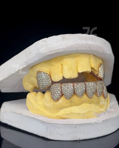 Iced Out Custom VVS Moissanite Diamond 925 Silver Grillz